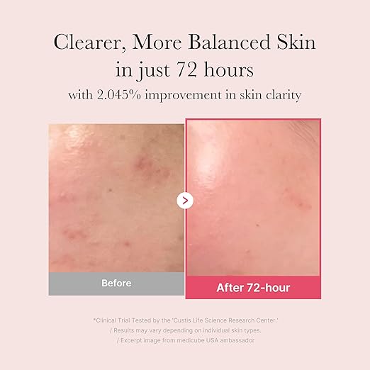Tranexamic Acid Trace Toning Serum