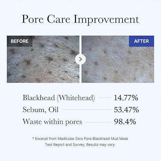 Zero Pore Blackhead Mud Pack
