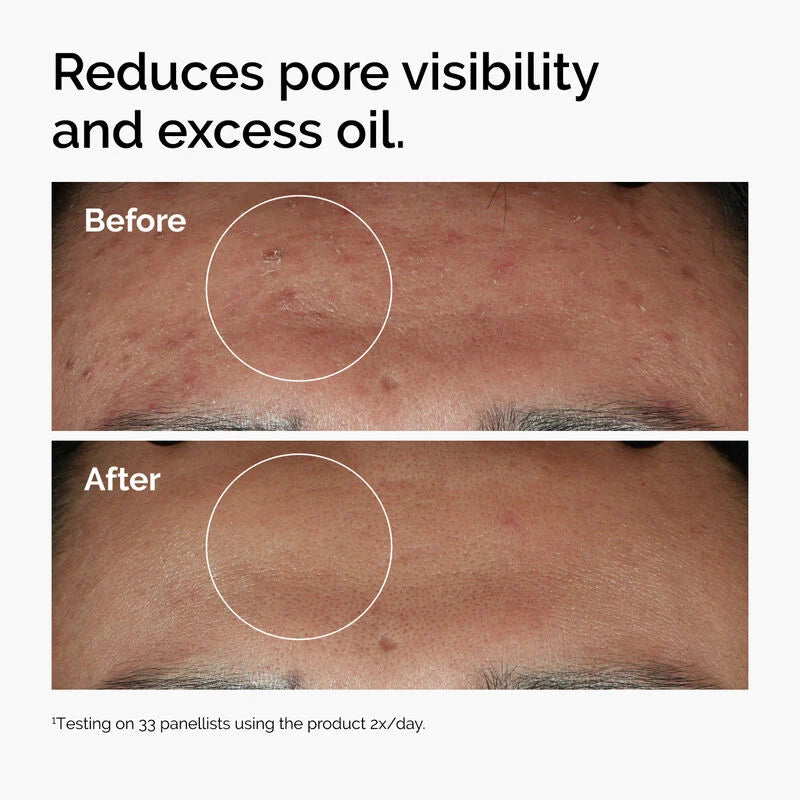 The Ordinary Niacinamide 10% + Zinc 1% 30 ml
