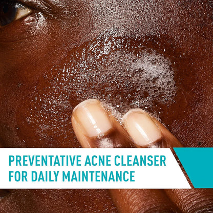 CeraVe Face Wash Acne Treatment Salicylic Acid Cleanser with Purifying Clay for Oily Skin Blackhead Remover and Clogged Pore Control 8 Ounce, multi, 8 Fl Oz, 237 ml 