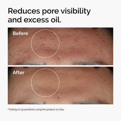 The Ordinary Niacinamide 10% + Zinc 1% 30 ml